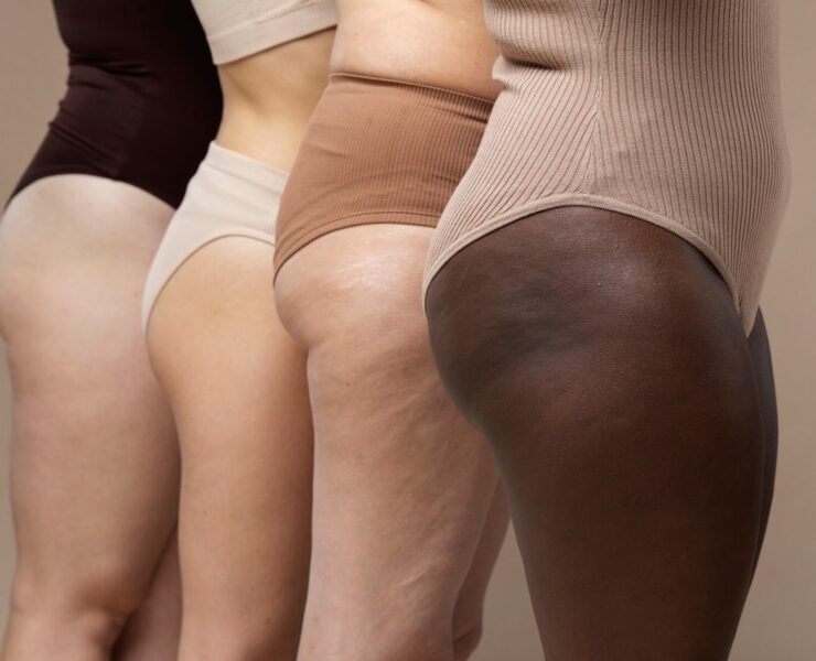 Prova Costume e cellulite